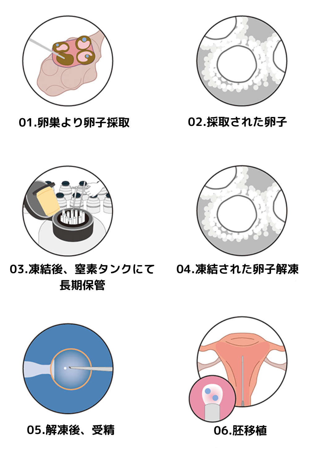 卵子凍結・自己卵子保存の概要